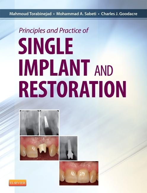 Principles and Practice of Single Implant and Restoration 1st Edition