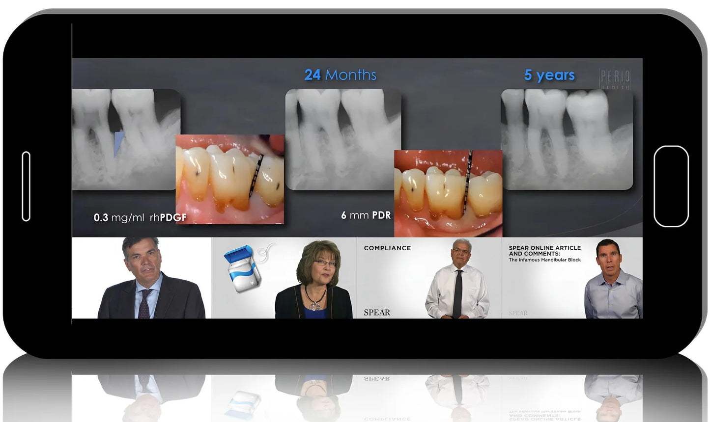 Periodontics in Restorative Practice: Smarter Diagnosis. Better Outcomes
