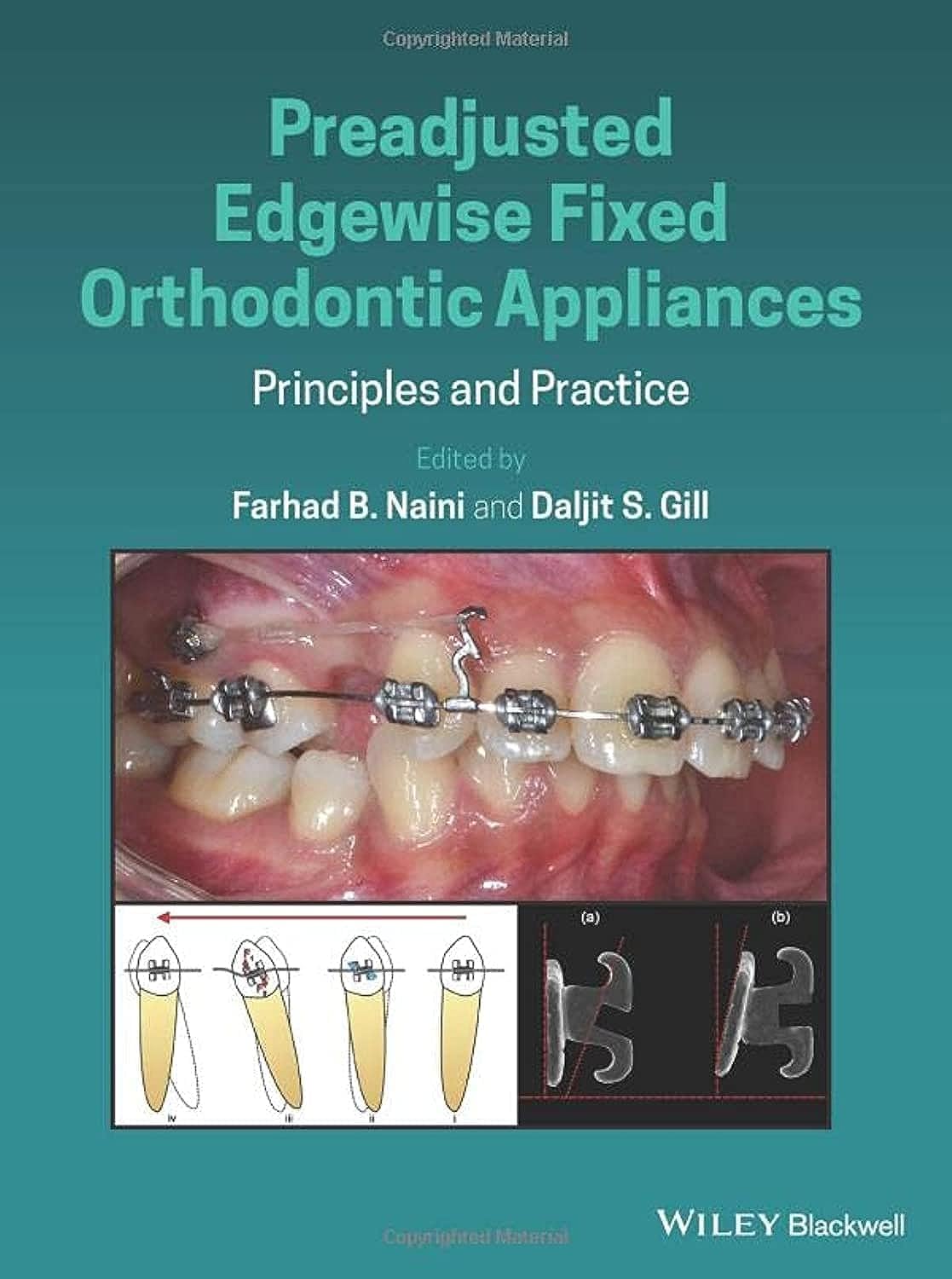 Preadjusted Edgewise Fixed Orthodontic Appliances: Principles and Practice 1st Edition