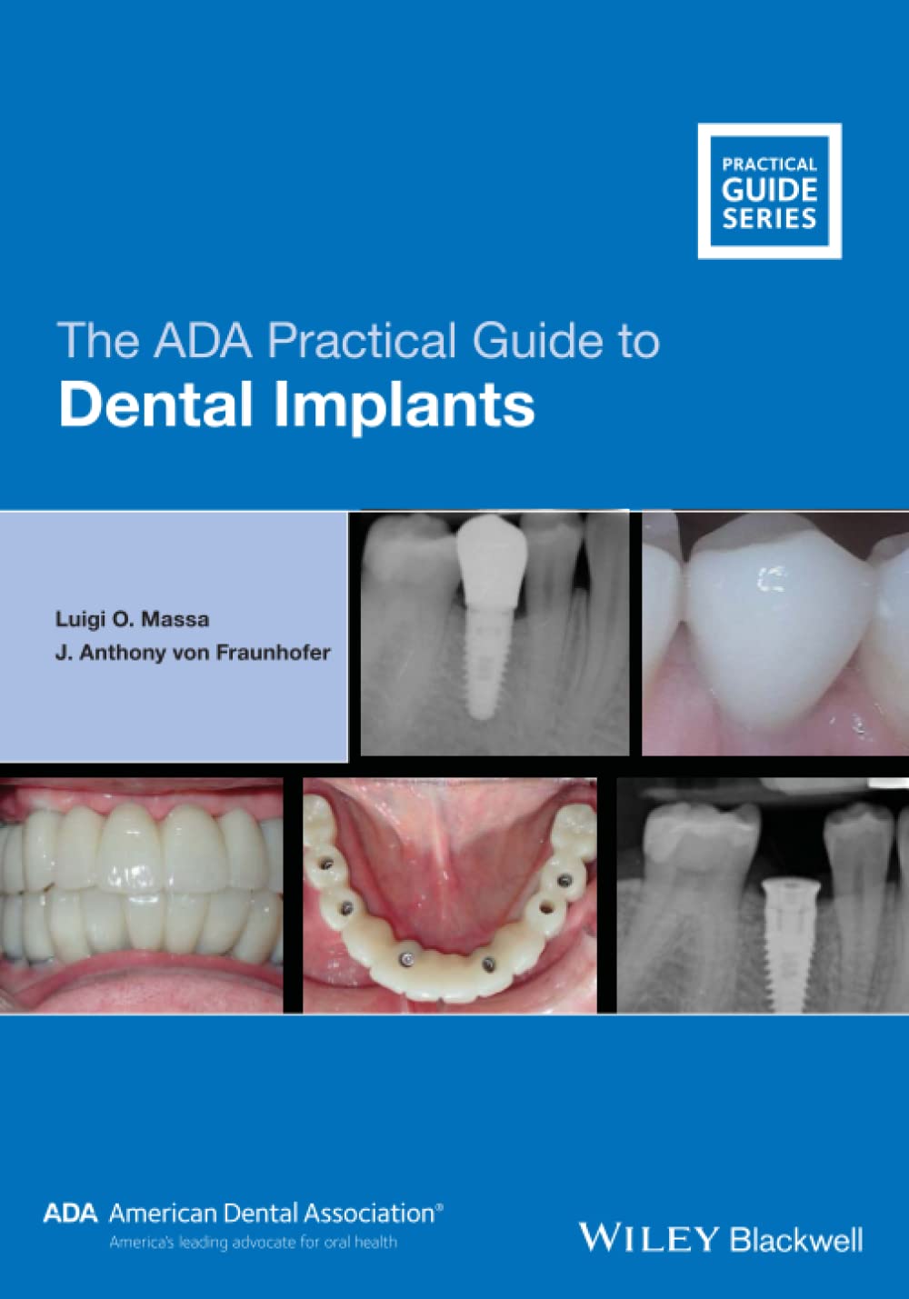 The ADA Practical Guide to Dental Implants 1st Edition