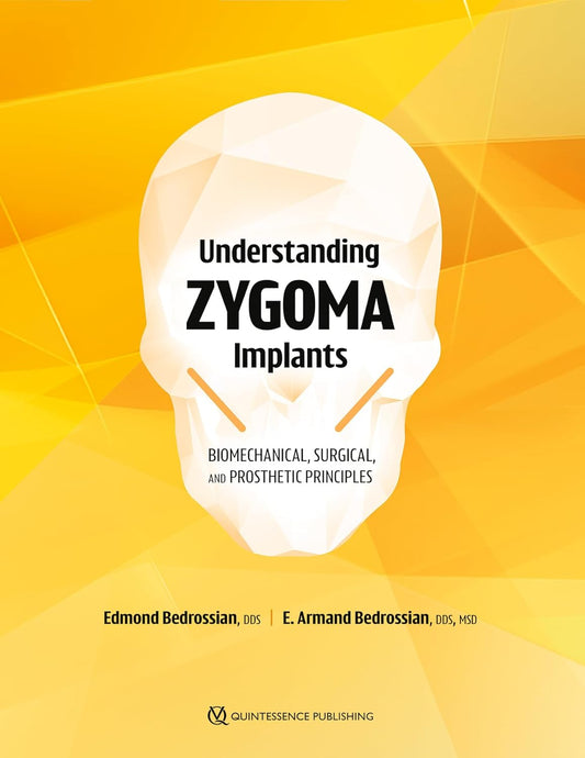 Understanding Zygoma Implants