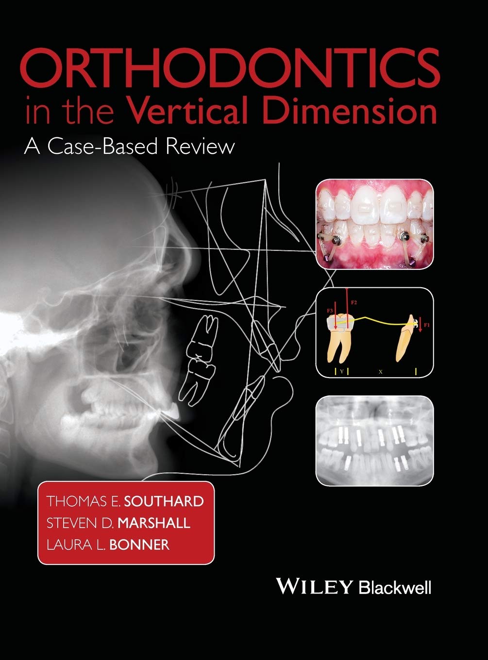 Orthodontics in the Vertical Dimension: A Case-Based Review 1st Edition