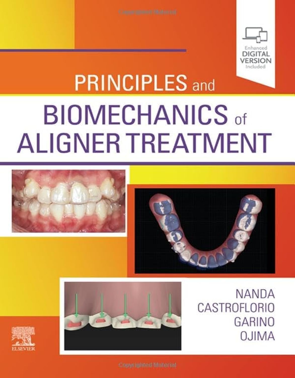 Principles and Biomechanics of Aligner Treatment 1st Edition