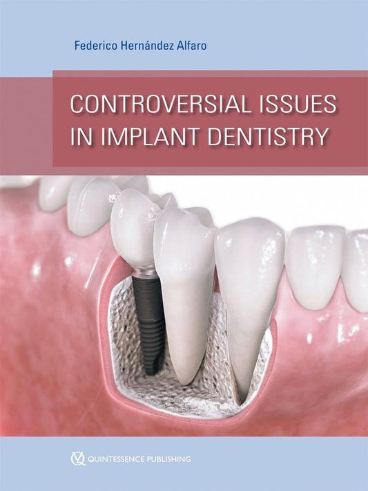 Controversial Issues in Implant Dentistry ( scanned copy)