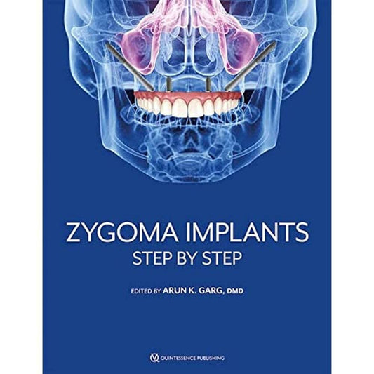 Zygoma Implants: Step by Step