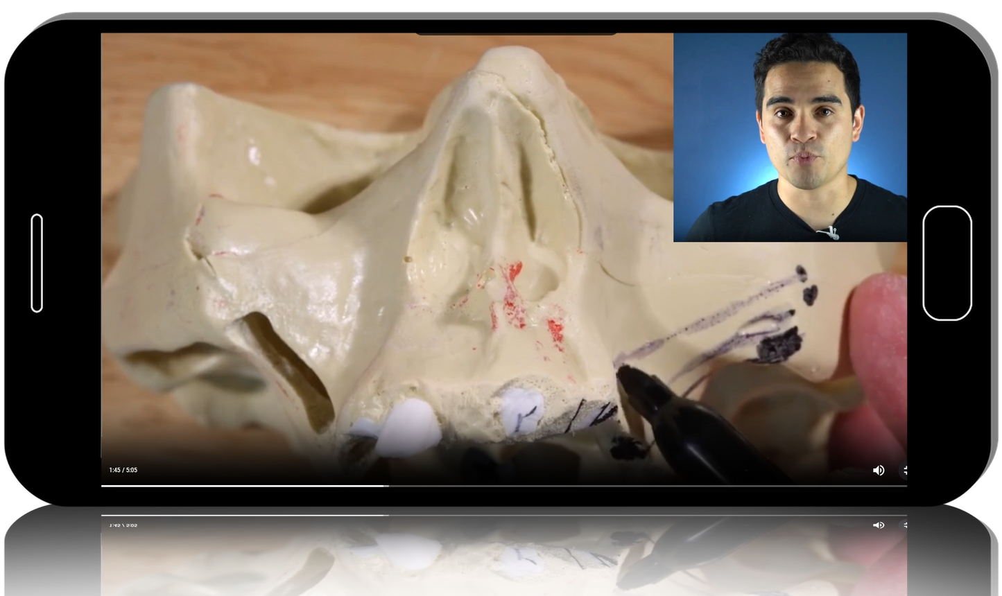 Zygomatic implant course