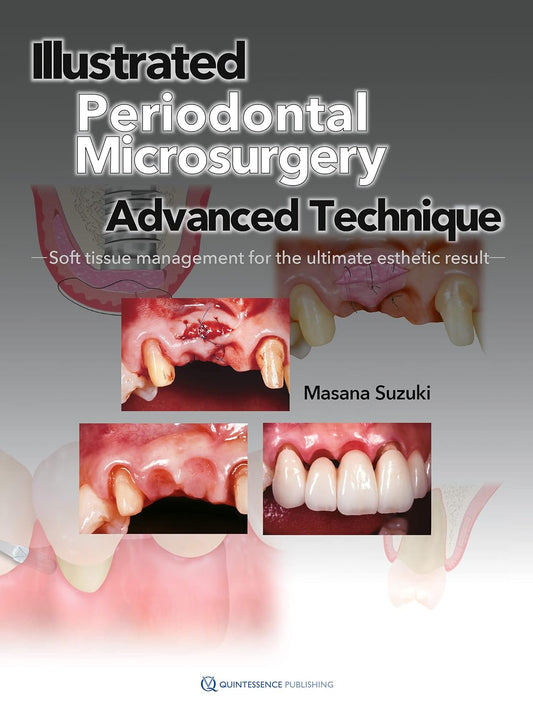 Illustrated Periodontal Microsurgery: Advanced Technique Soft Tissue Management for the Ultimate Esthetic Result (scanned copy)