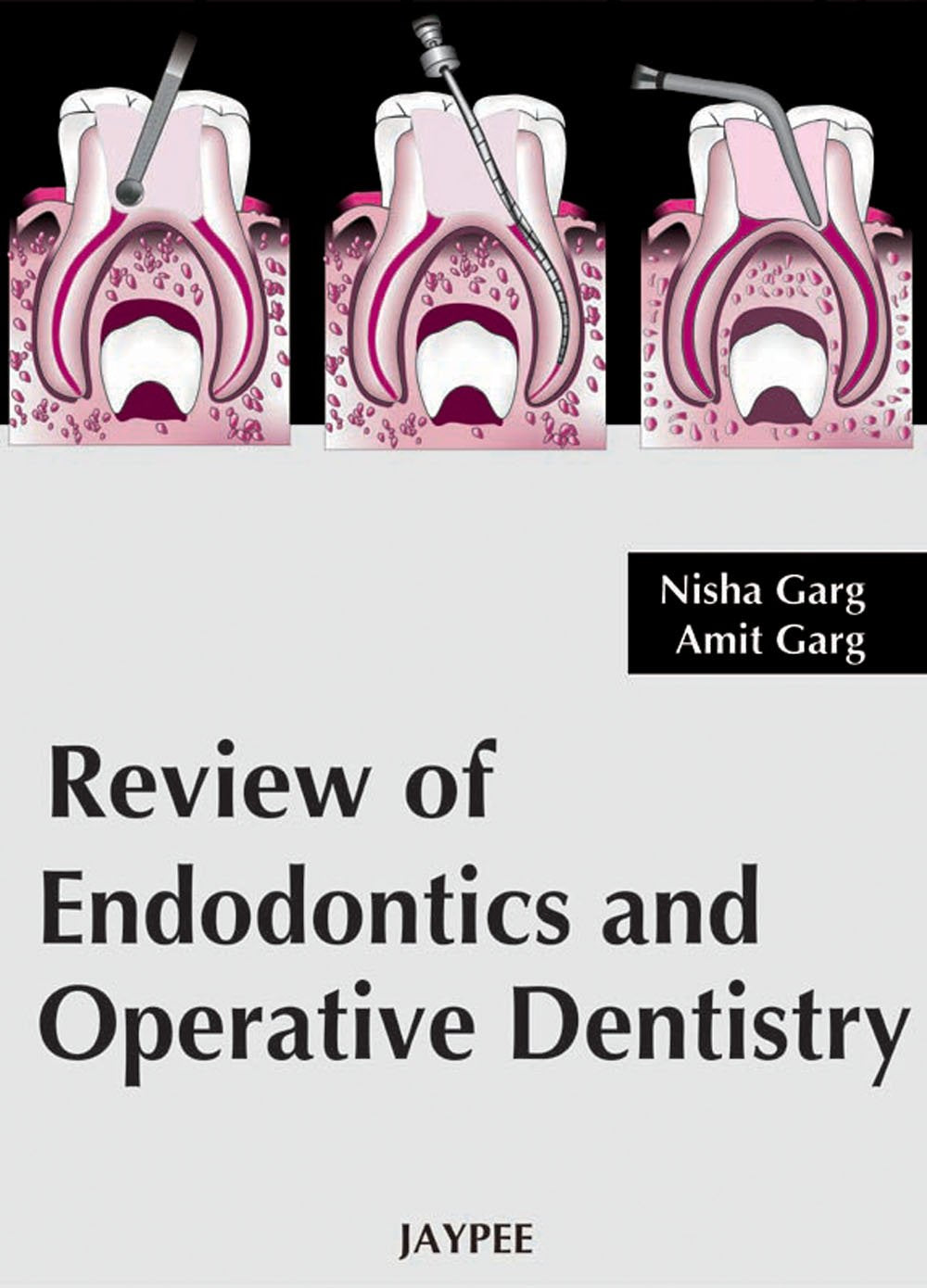 Review of Endodontics and Operative Dentistry