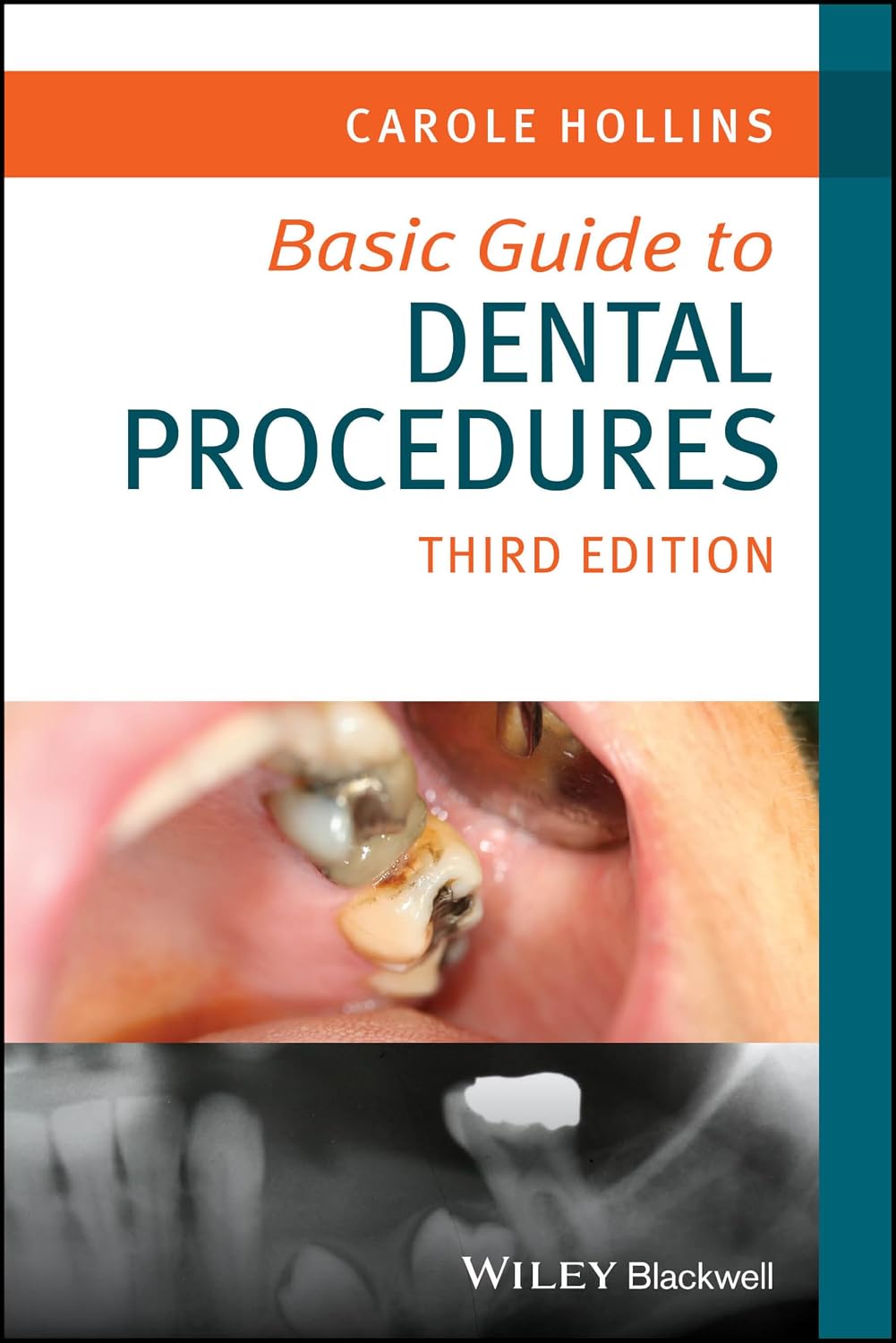 Basic Guide to Dental Procedures third Edition(PDF) 2025