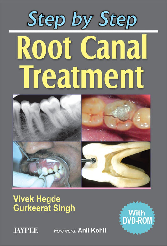 Step by Step: Root Canal Treatment