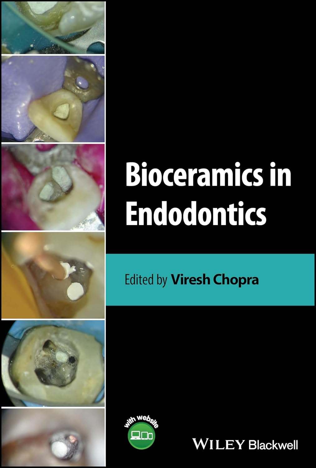 Bioceramics in Endodontics 1st Edition