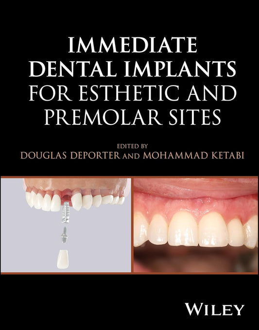 Immediate Dental Implants for Esthetic and Premolar Sites - 09 September 2025