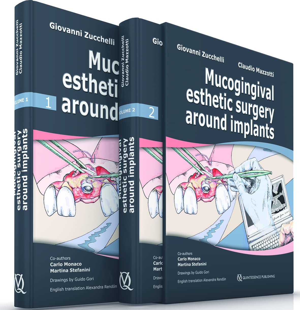 Mucogingival Esthetic Surgery around Implants ( 2 Volumes)