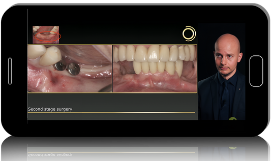 Biological Bone Augmentation