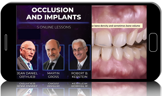 Occlusion and Implants