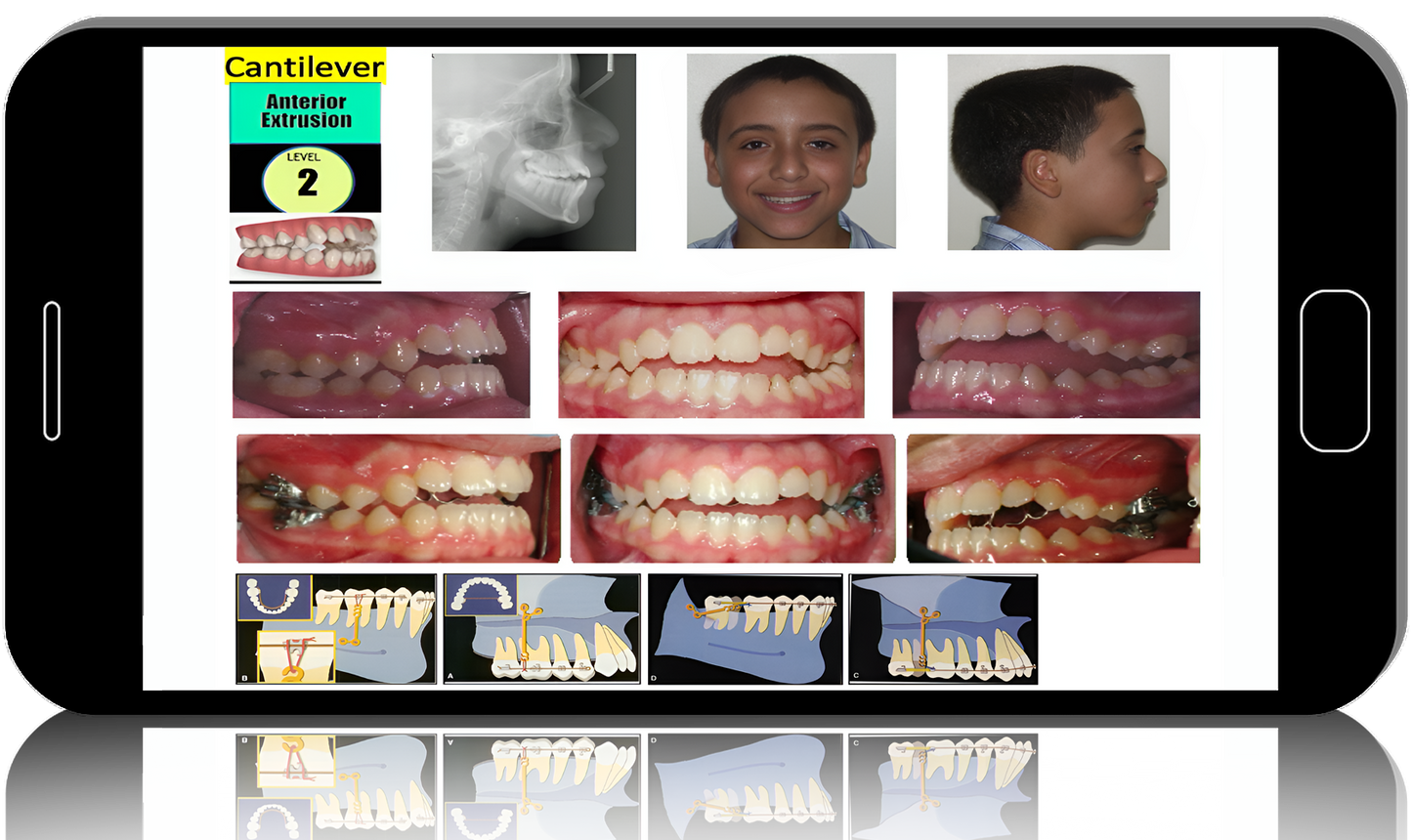 American Association of Orthodontists Annual Session Conference 2022