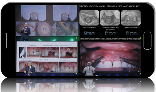 Implants in the Aesthetic Zone: From Successful Placement to Failure Management 2025