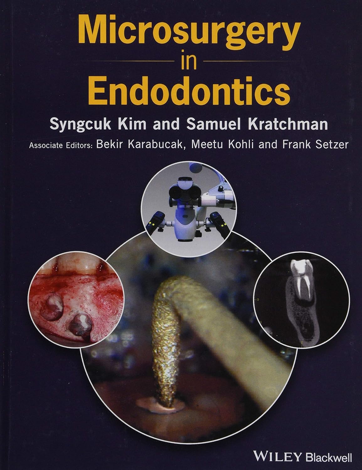 Microsurgery in Endodontics, 1st Edition