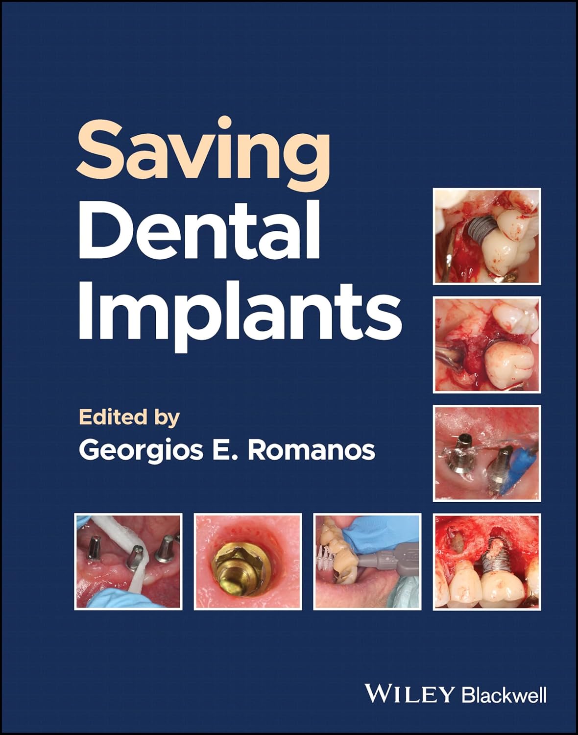 Saving Dental Implants 1st Edition