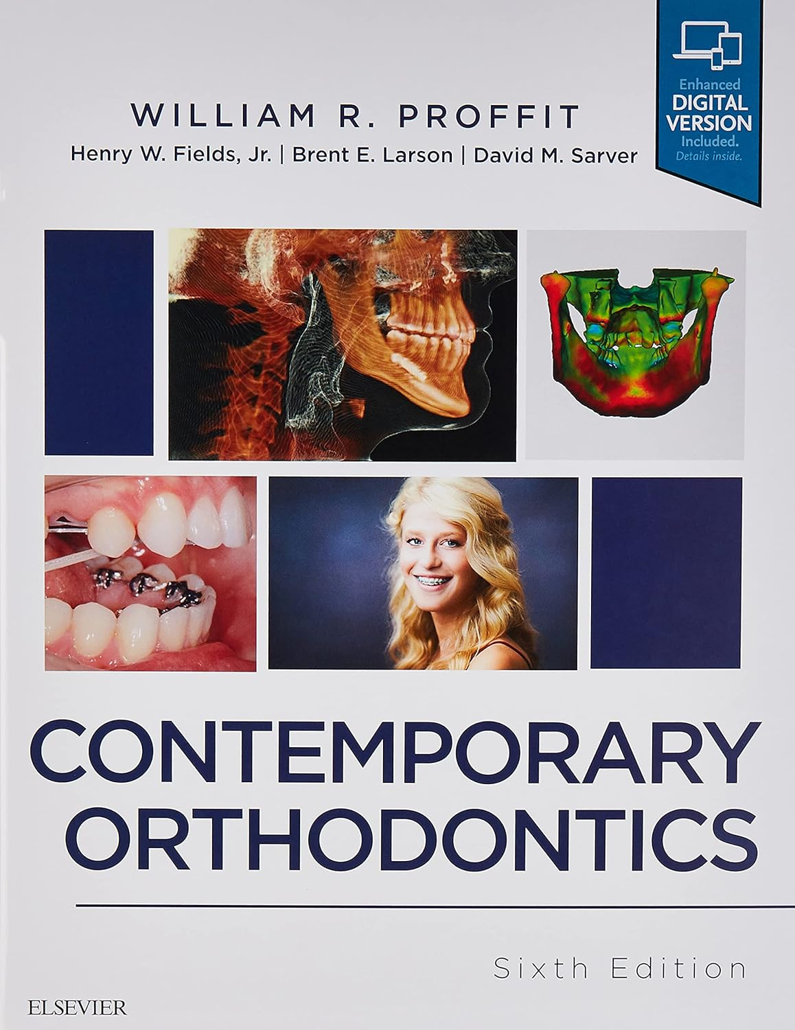 Contemporary Orthodontics 6th Edition
