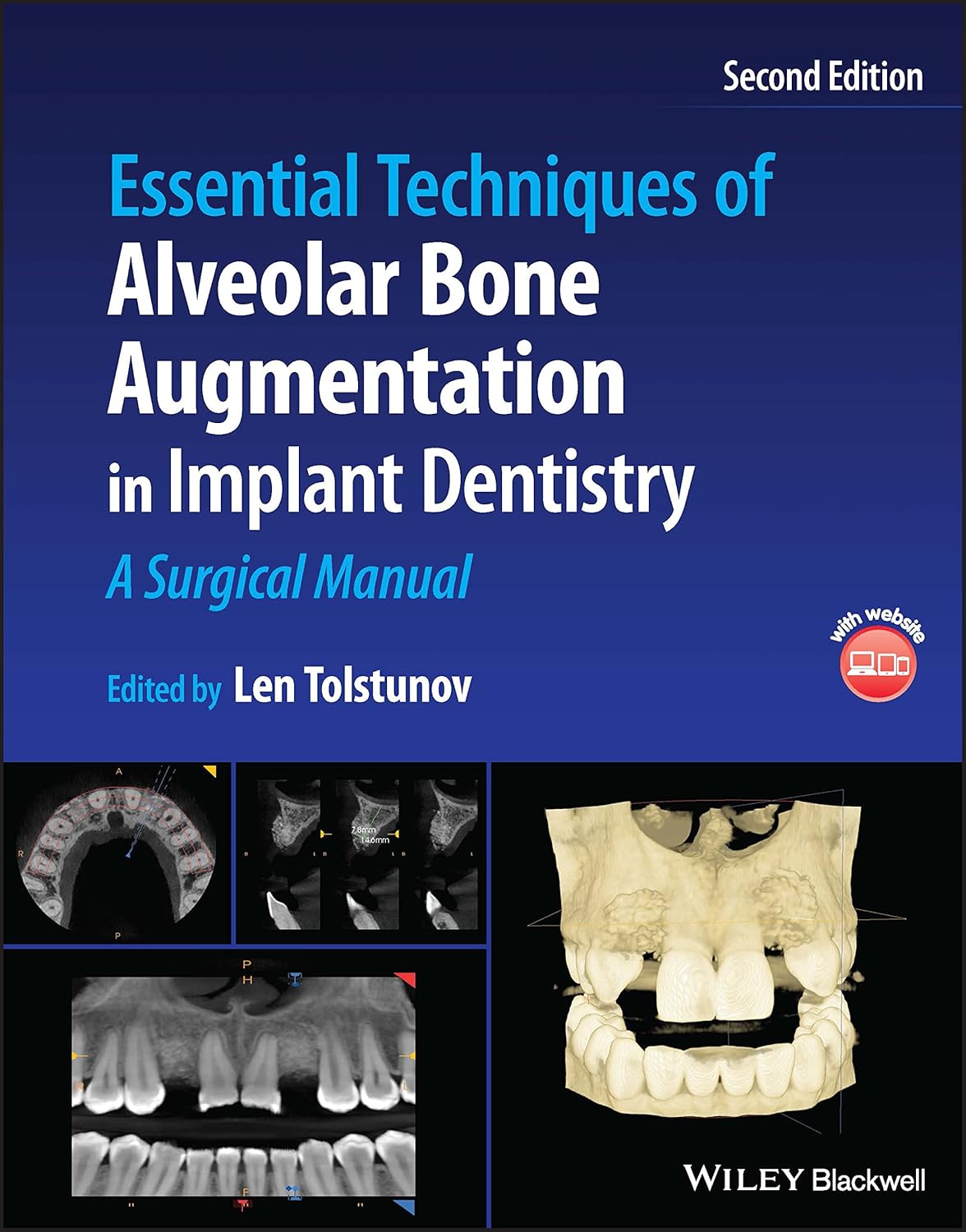 Essential Techniques of Alveolar Bone Augmentation in Implant Dentistry: A Surgical Manual 2nd Edition