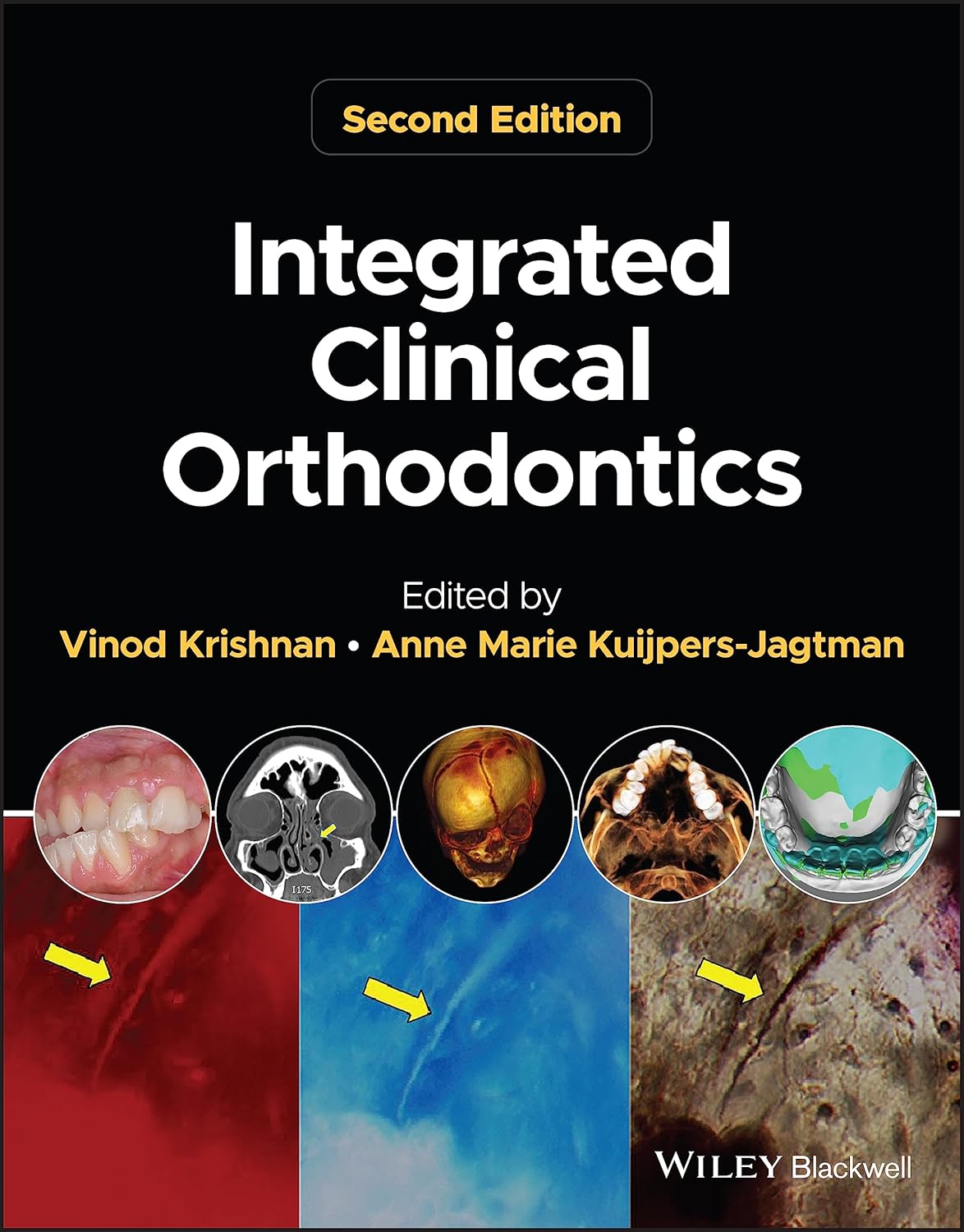 Integrated Clinical Orthodontics 2nd Edition