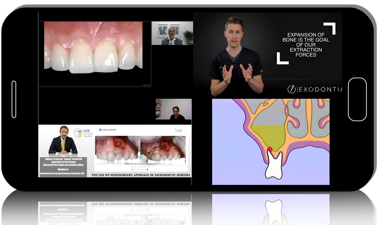 Complete rehabilitation: an interdisciplinary approach in surgery and prosthetics