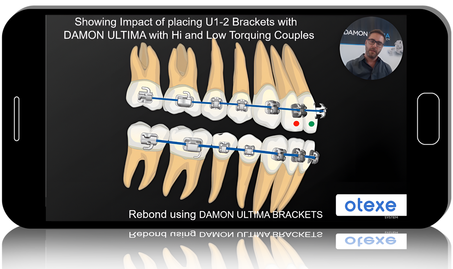 A Course on Damon Ultima