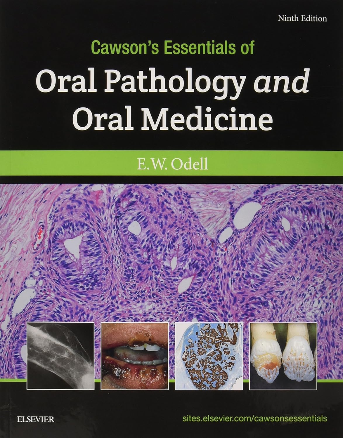 Cawson's Essentials of Oral Pathology and Oral Medicine 9th Edition