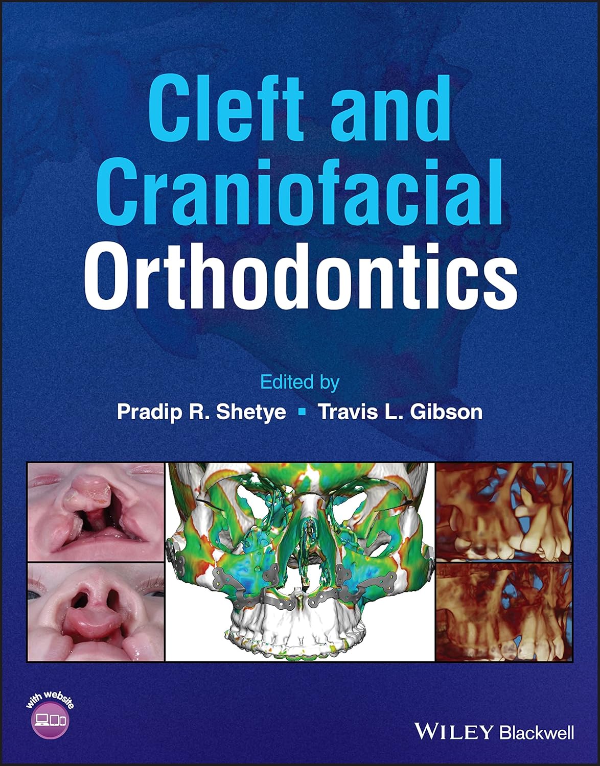 Cleft and Craniofacial Orthodontics 1st Edition