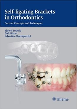 Self-ligating Brackets in Orthodontics: Current Concepts and Techniques