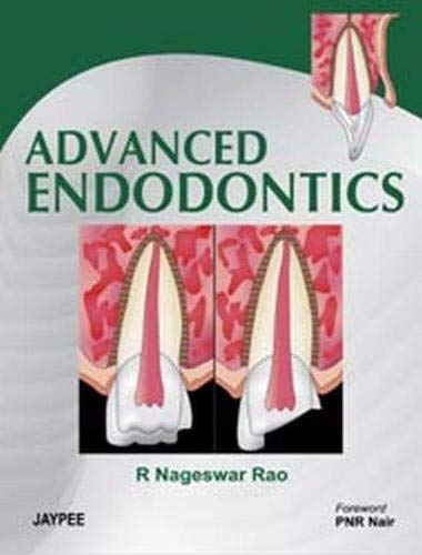 Advanced Endodontics, 1st edition
