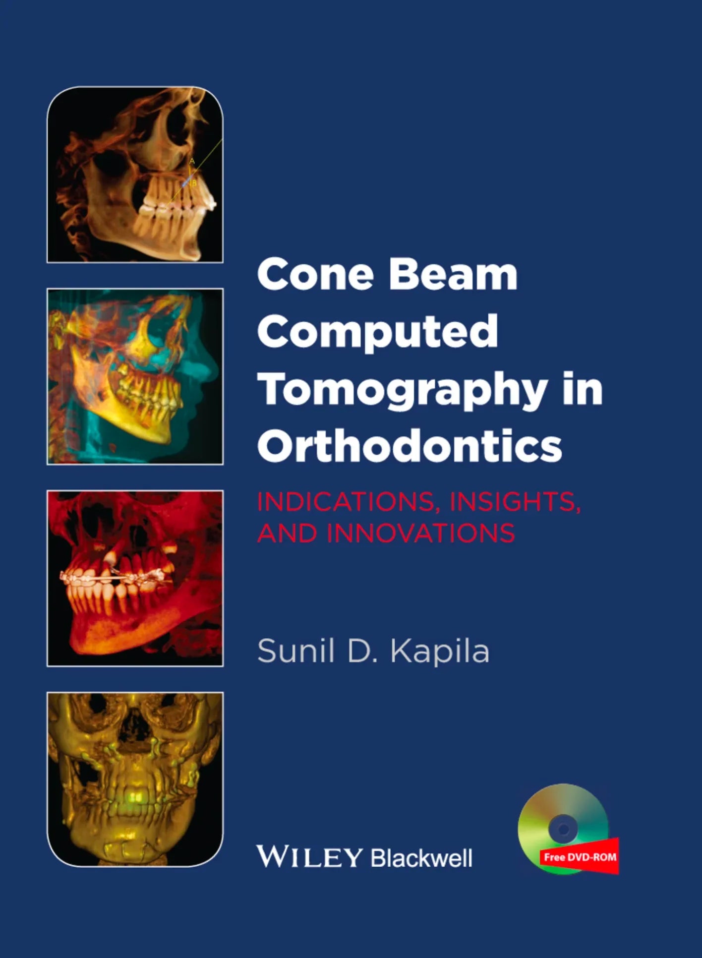 Cone Beam Computed Tomography in Orthodontics: Indications, Insights, and Innovations
