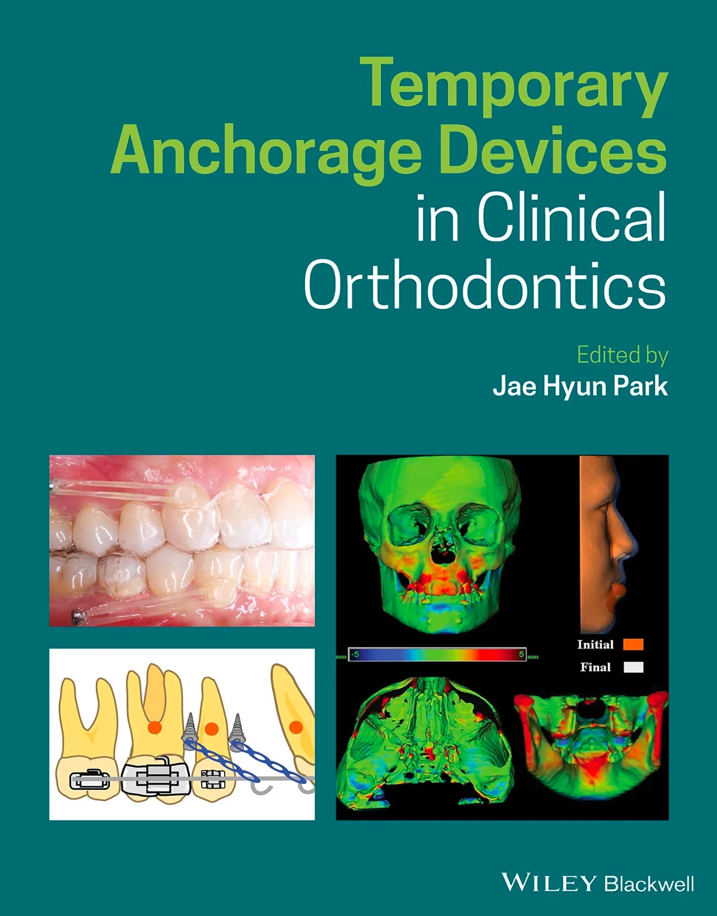 Temporary Anchorage Devices in Clinical Orthodontics