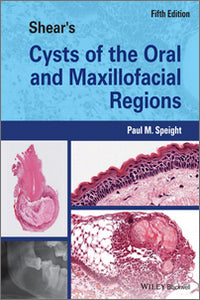 Shear’s Cysts of the Oral and Maxillofacial Regions, 5th Edition