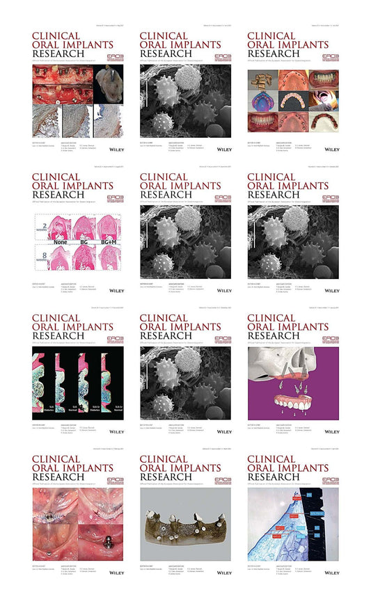 Clinical Oral Implants Research 2021 Full Archives