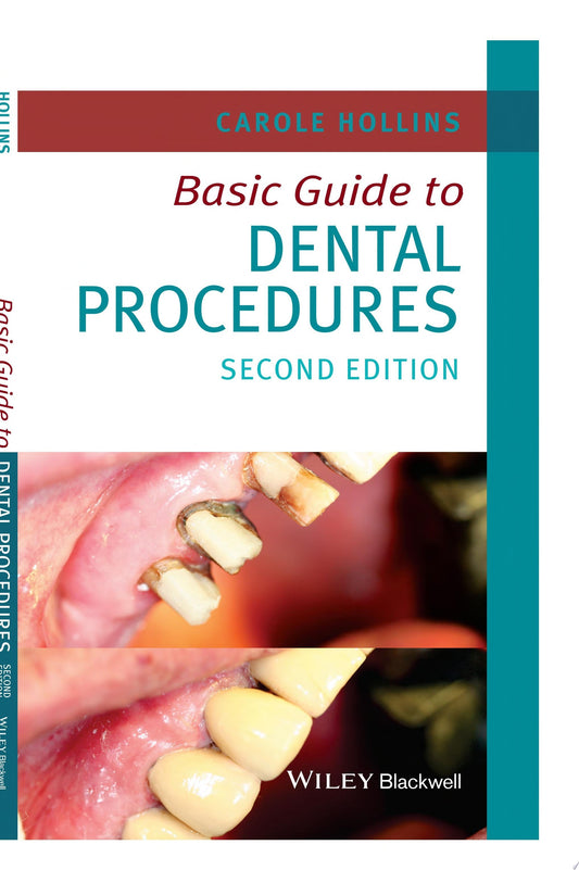 Basic Guide to Dental Procedures