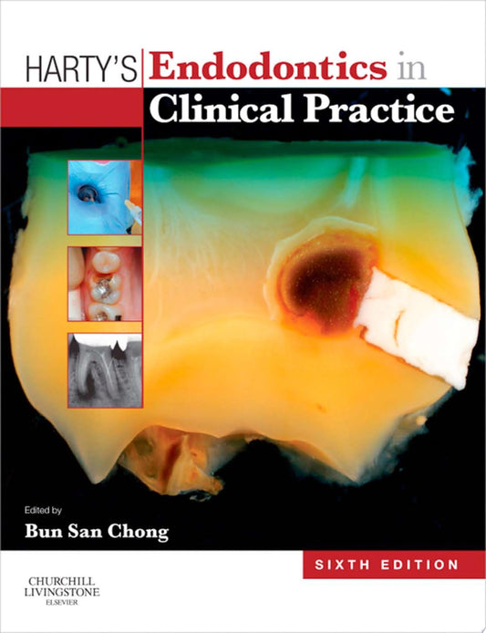 Harty's Endodontics in Clinical Practice
