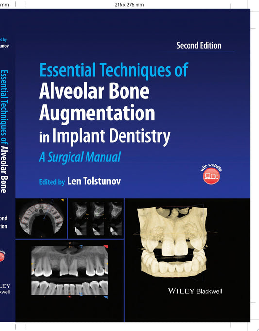Essential Techniques of Alveolar Bone Augmentation in Implant Dentistry