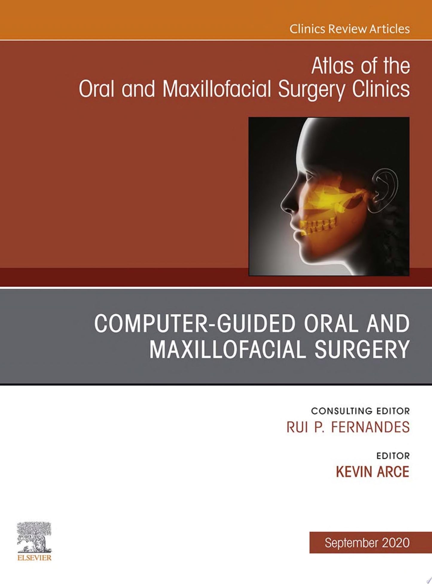Guided Oral and Maxillofacial Surgery An Issue of Atlas of the Oral & Maxillofacial Surgery Clinics, E-Book