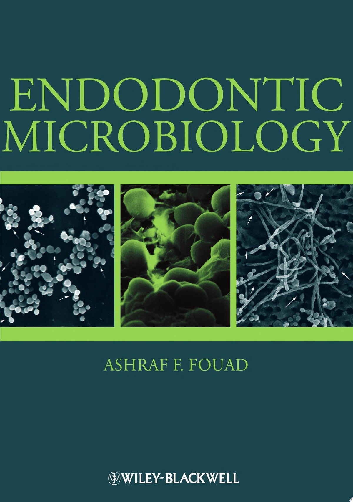 Endodontic Microbiology