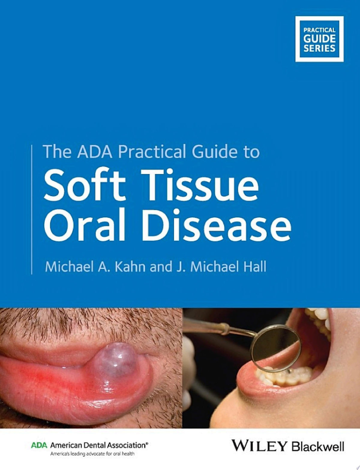 The ADA Practical Guide to Soft Tissue Oral Disease