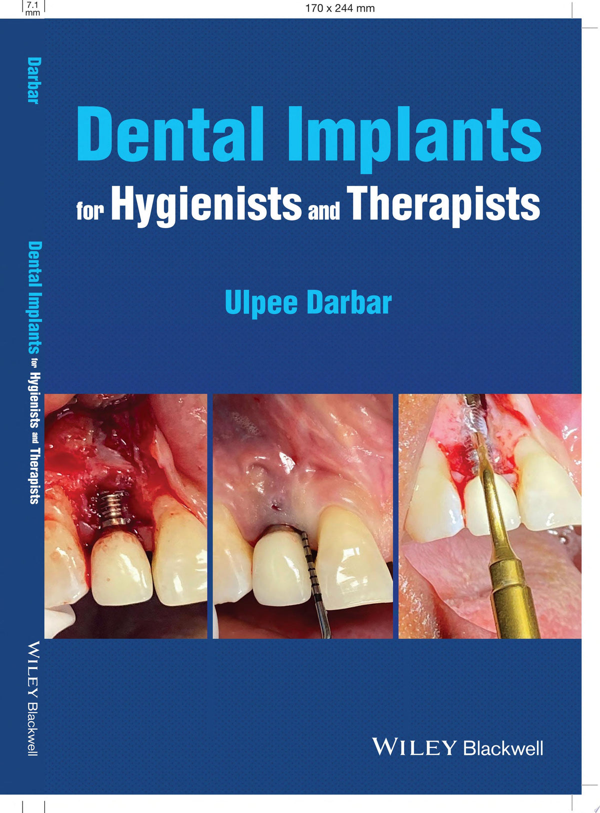 Dental Implants for Hygienists and Therapists