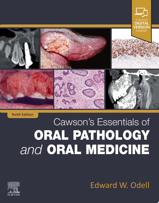 Cawson's Essentials of Oral Pathology and Oral Medicine - E-Book