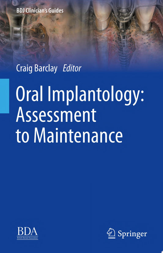 Oral Implantology: Assessment to Maintenance (BDJ Clinician’s Guides) 2024th Edition