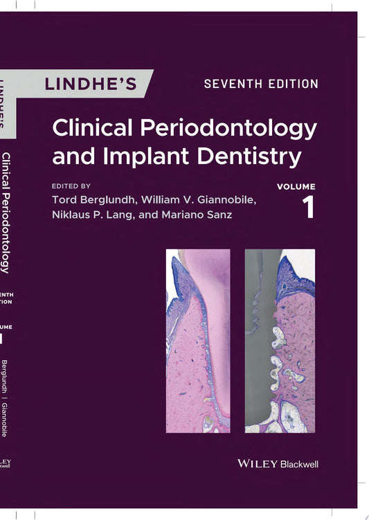 Lindhe's Clinical Periodontology and Implant Dentistry, 2 Volume Set