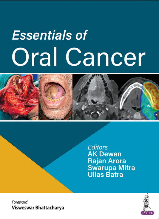 Essentials of Oral Cancer
