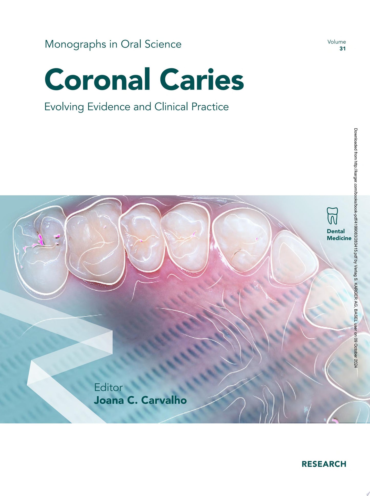 Coronal Caries: Evolving Evidence and Clinical Practice Hardcover