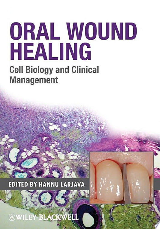 Oral Wound Healing