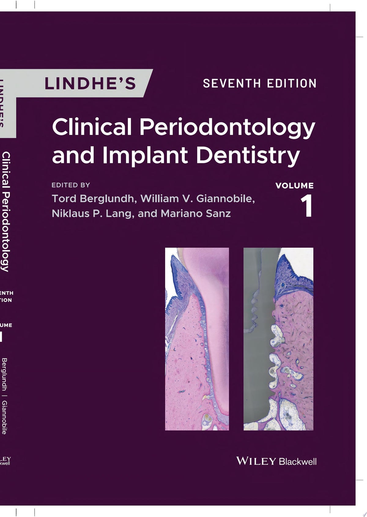 Lindhe's Clinical Periodontology and Implant Dentistry